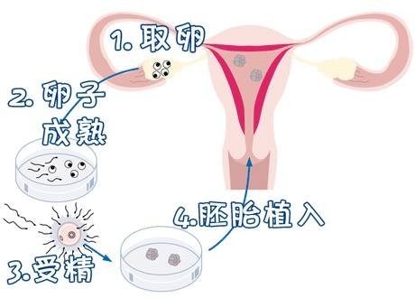 私人同性代怀助孕怎么收费